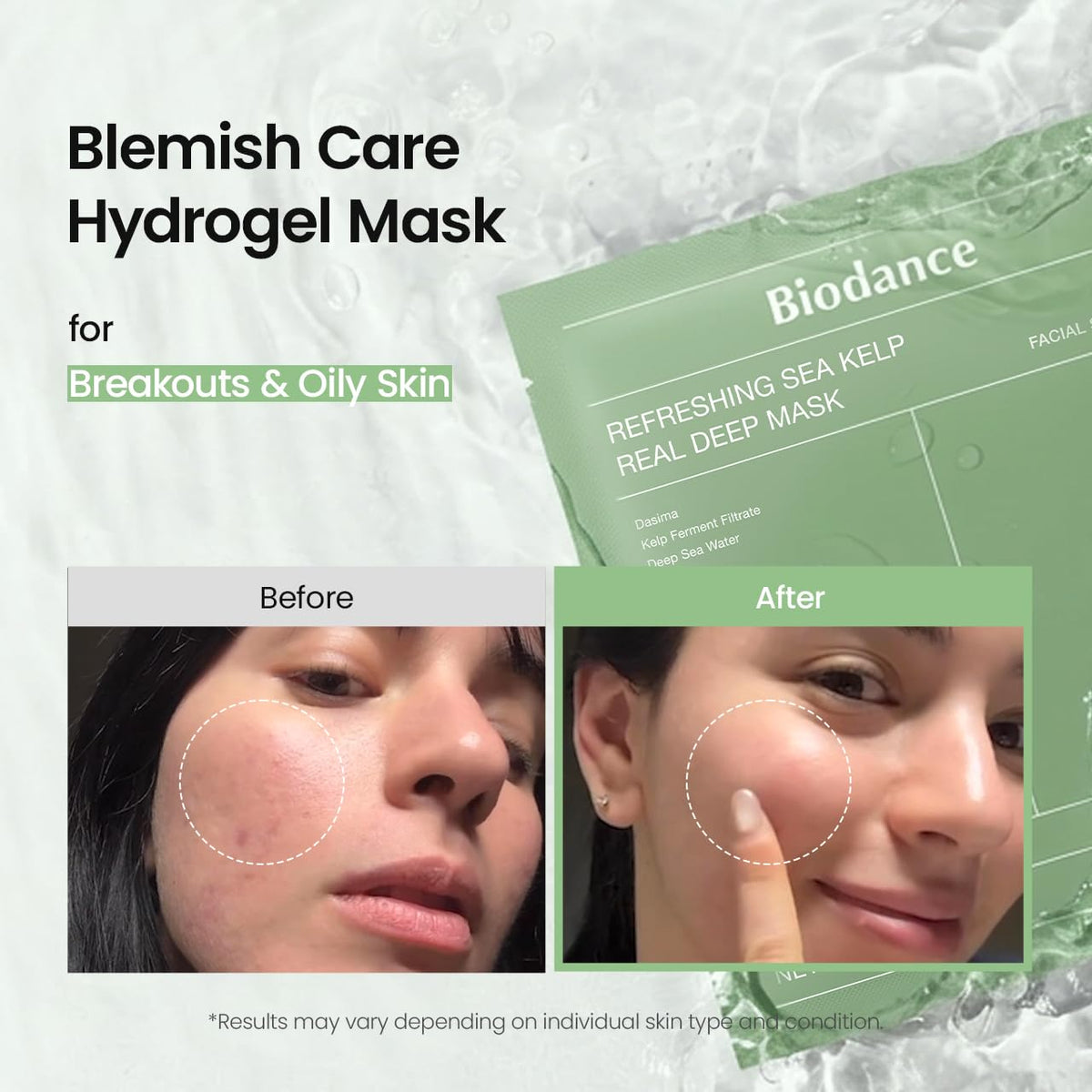BIODANCE Rejuvenating Caviar PDRN Real Deep Mask, Overnight Hydrogel Face Mask, Skin Firming, Radiance, Enhancing Skin Recovery, Korean Skin Care, Self Care Gifts for Women | 1.19oz(34g) x 4ea