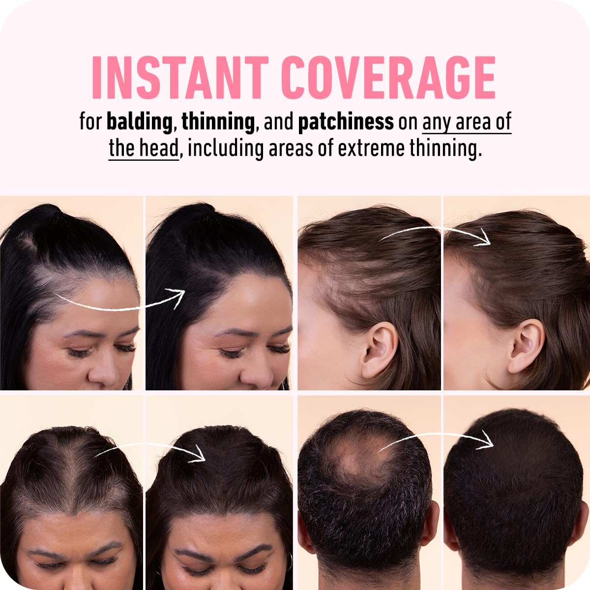 Boldify Hairline Powder, Root Touch Up Hair Color Light Brown 4g