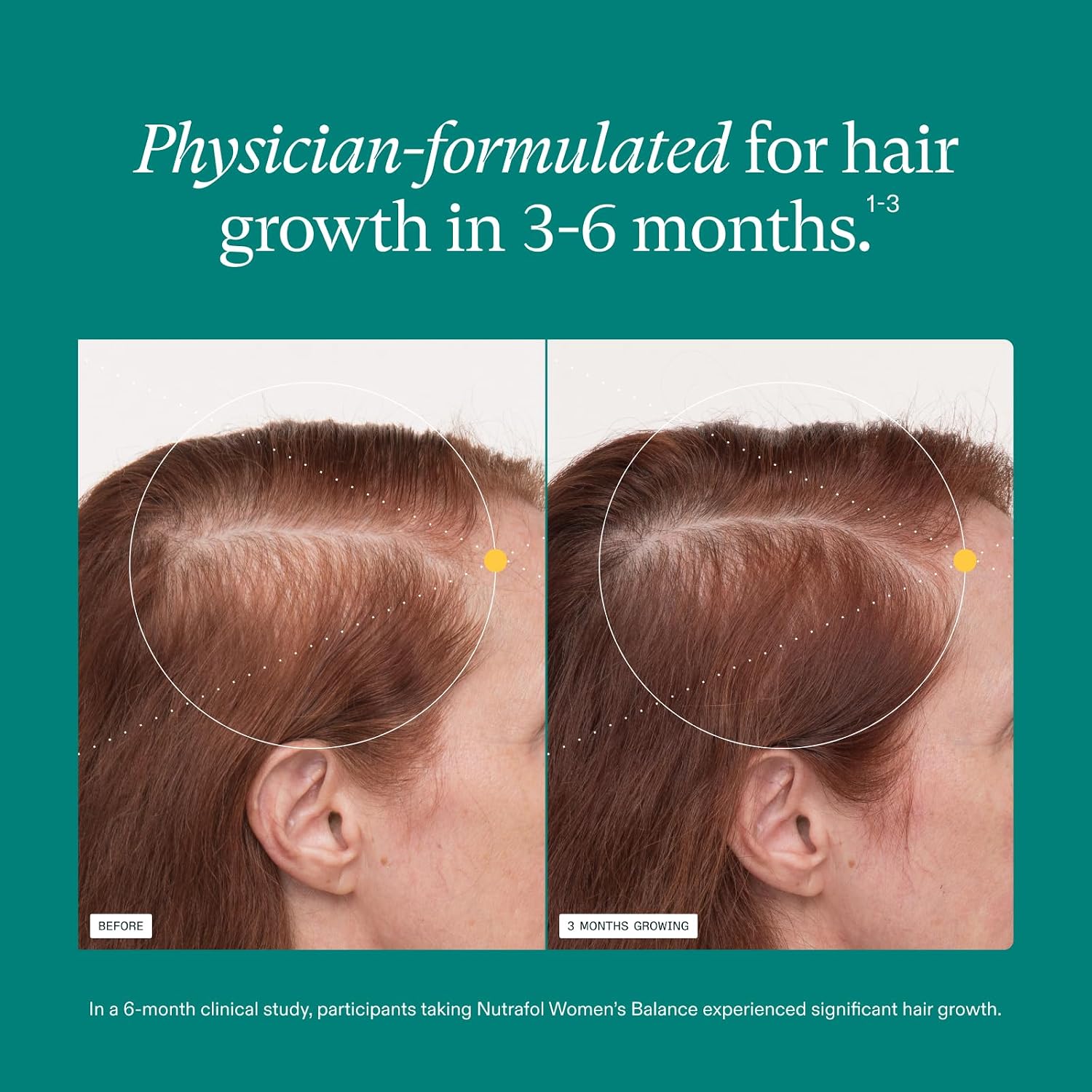 Nutrafol Women's Balance Hair Growth Supplements, Age 45+